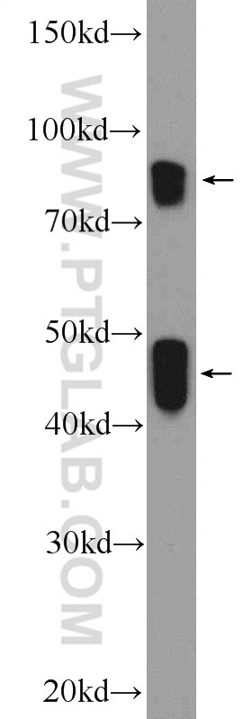 Western Blot (WB) analysis of Jurkat cells using CRACR2A Polyclonal antibody (15206-1-AP)