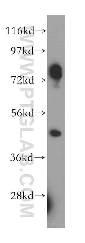Western Blot (WB) analysis of HeLa cells using CRACR2A Polyclonal antibody (15206-1-AP)