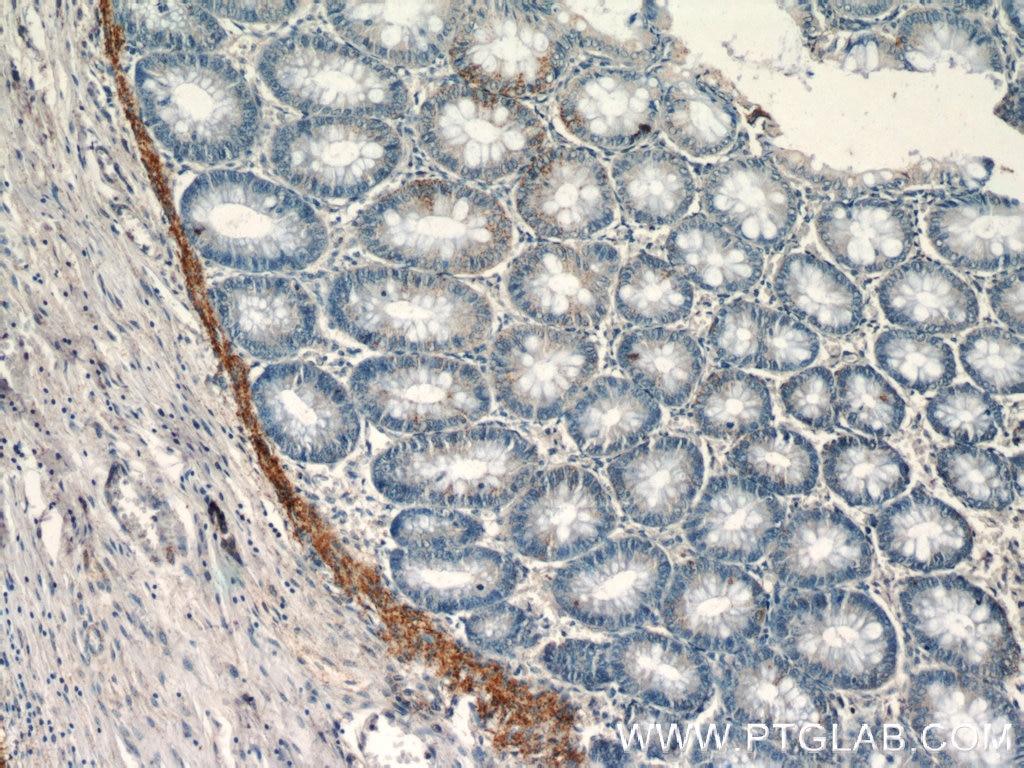 Immunohistochemistry (IHC) staining of human colon tissue using EFCAB5 Polyclonal antibody (24296-1-AP)