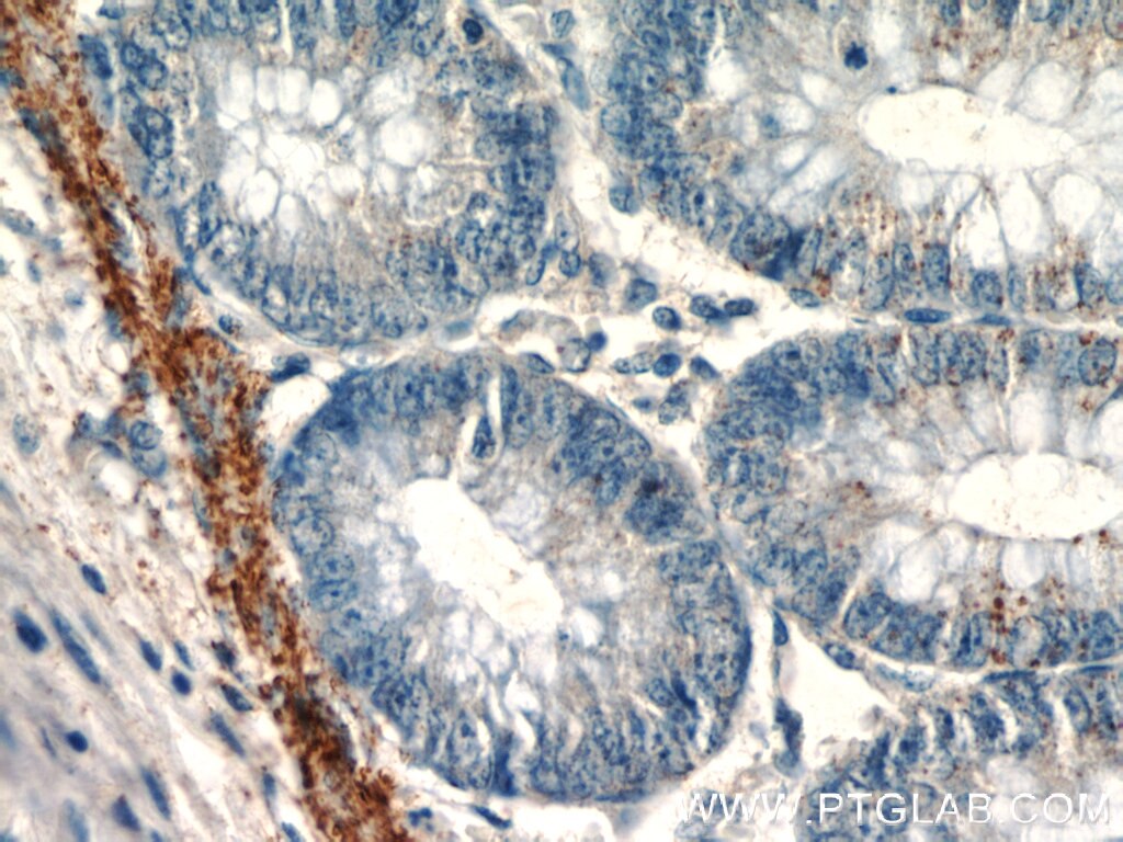 Immunohistochemistry (IHC) staining of human colon tissue using EFCAB5 Polyclonal antibody (24296-1-AP)