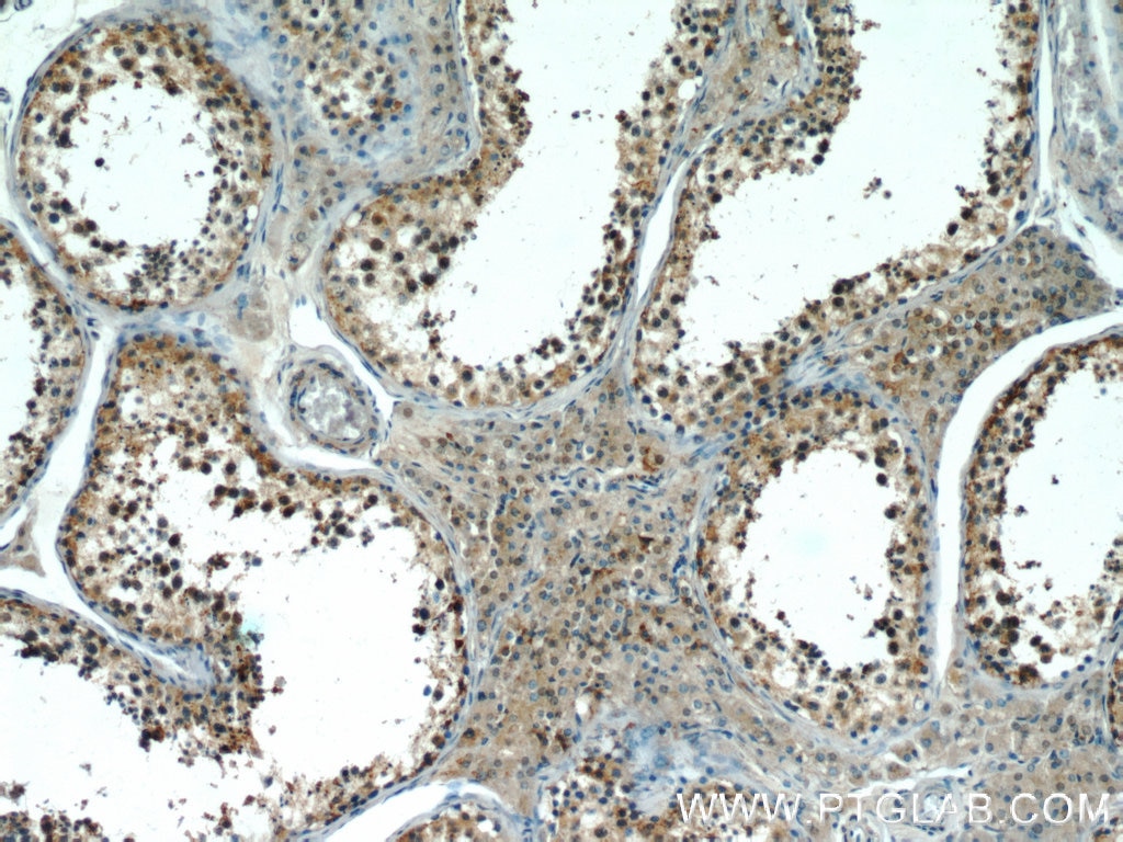 Immunohistochemistry (IHC) staining of human testis tissue using EFCAB5 Polyclonal antibody (24296-1-AP)