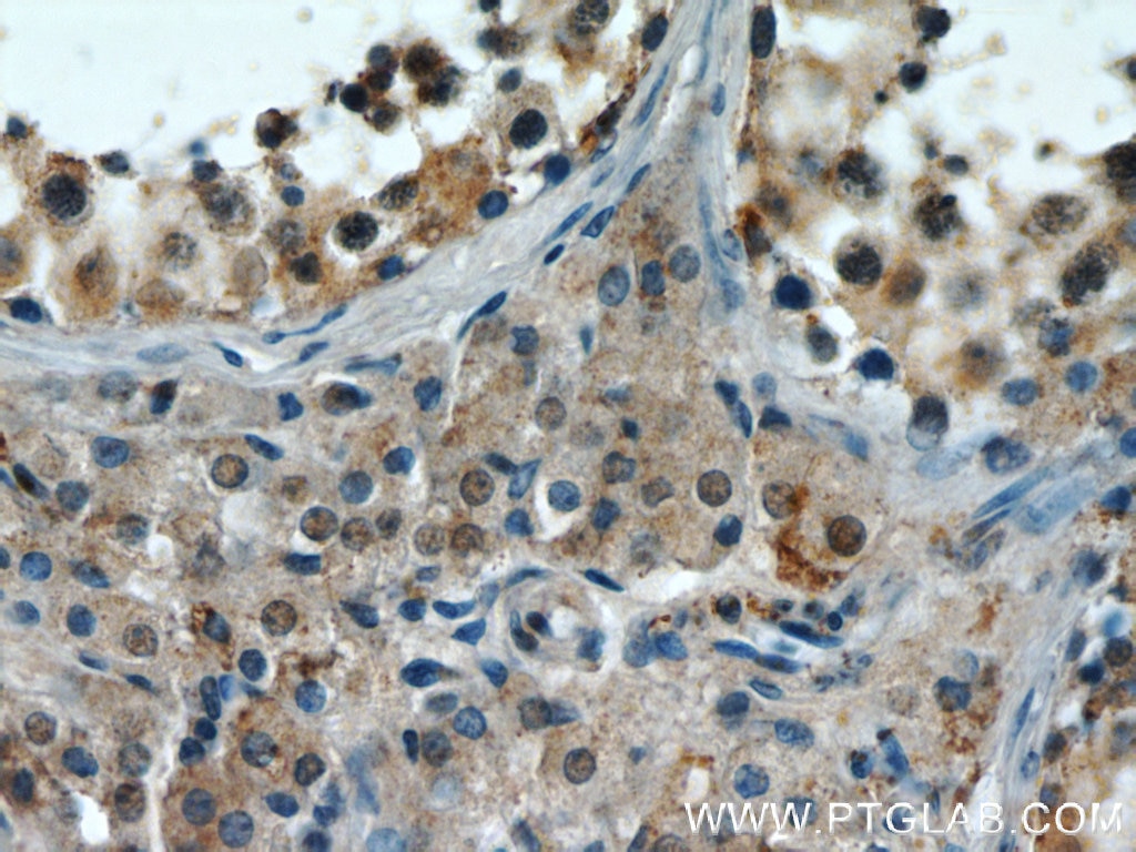 Immunohistochemistry (IHC) staining of human testis tissue using EFCAB5 Polyclonal antibody (24296-1-AP)