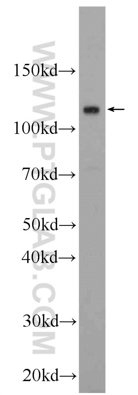 WB analysis of L02 using 24296-1-AP