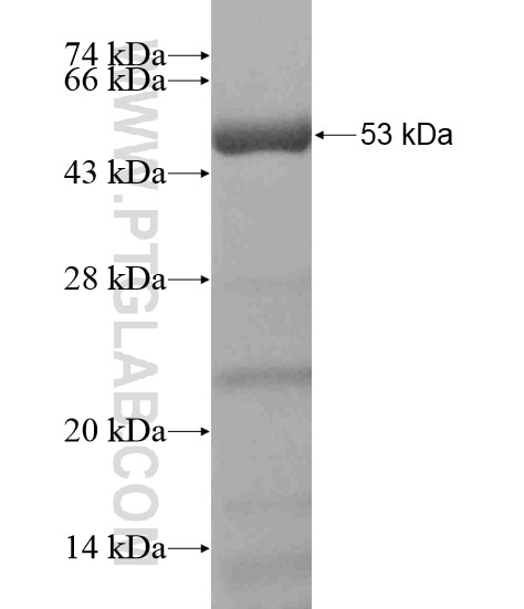 EFCAB5 fusion protein Ag19274 SDS-PAGE