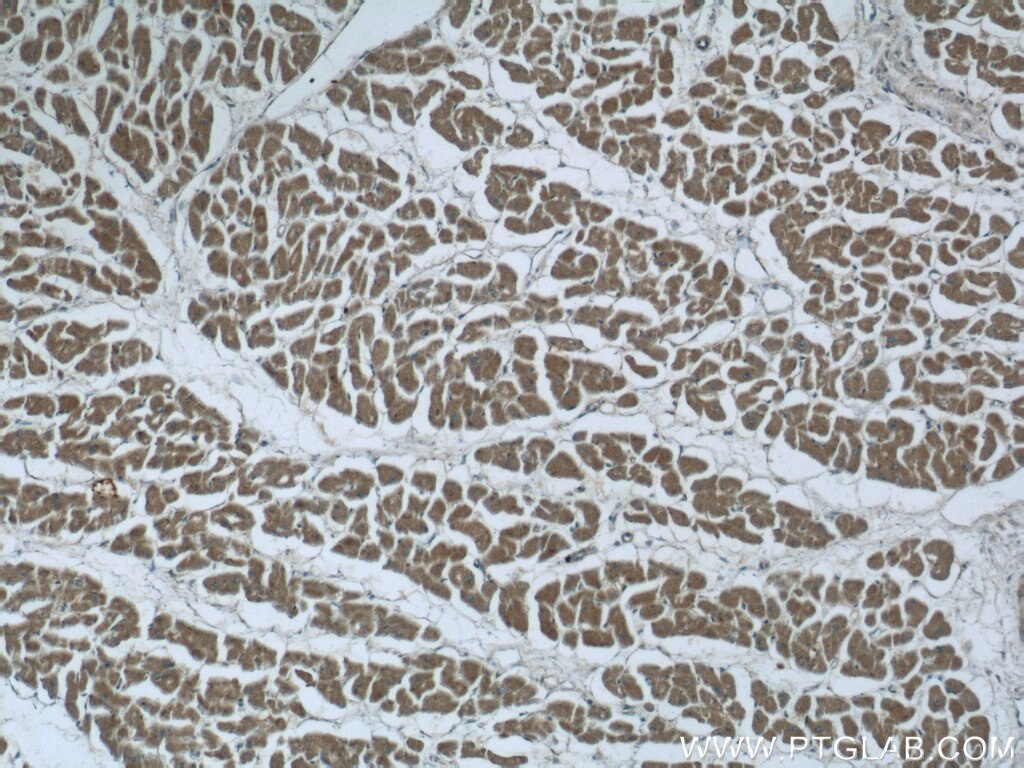 Immunohistochemistry (IHC) staining of human heart tissue using EFEMP2 Polyclonal antibody (12004-1-AP)