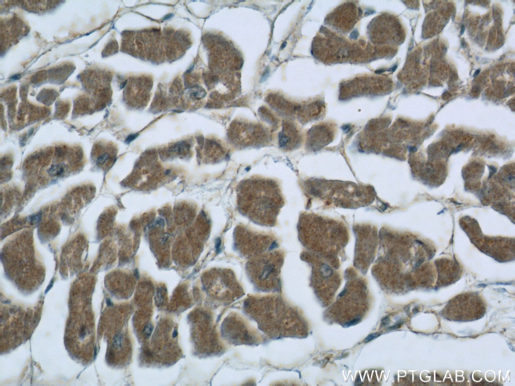Immunohistochemistry (IHC) staining of human heart tissue using EFEMP2 Polyclonal antibody (12004-1-AP)