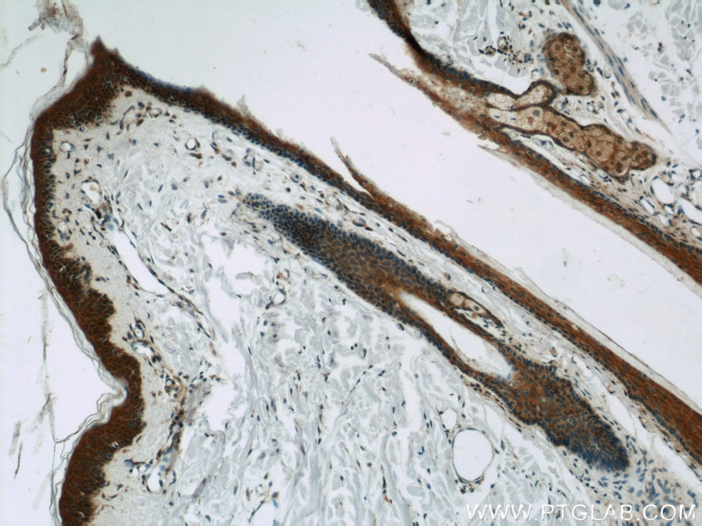 IHC staining of human skin using 12004-1-AP