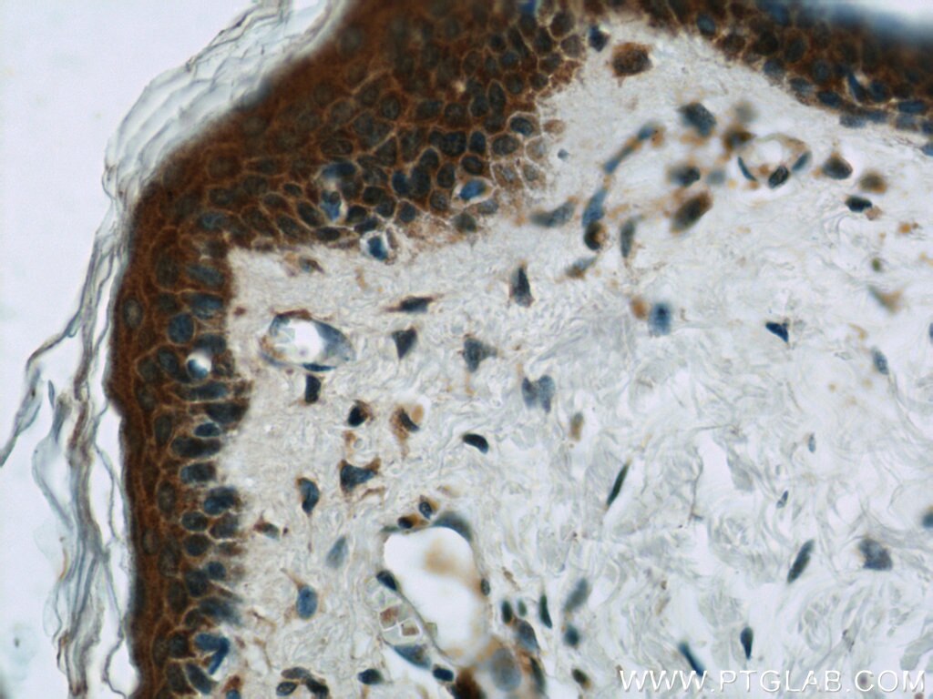 Immunohistochemistry (IHC) staining of human skin tissue using EFEMP2 Polyclonal antibody (12004-1-AP)