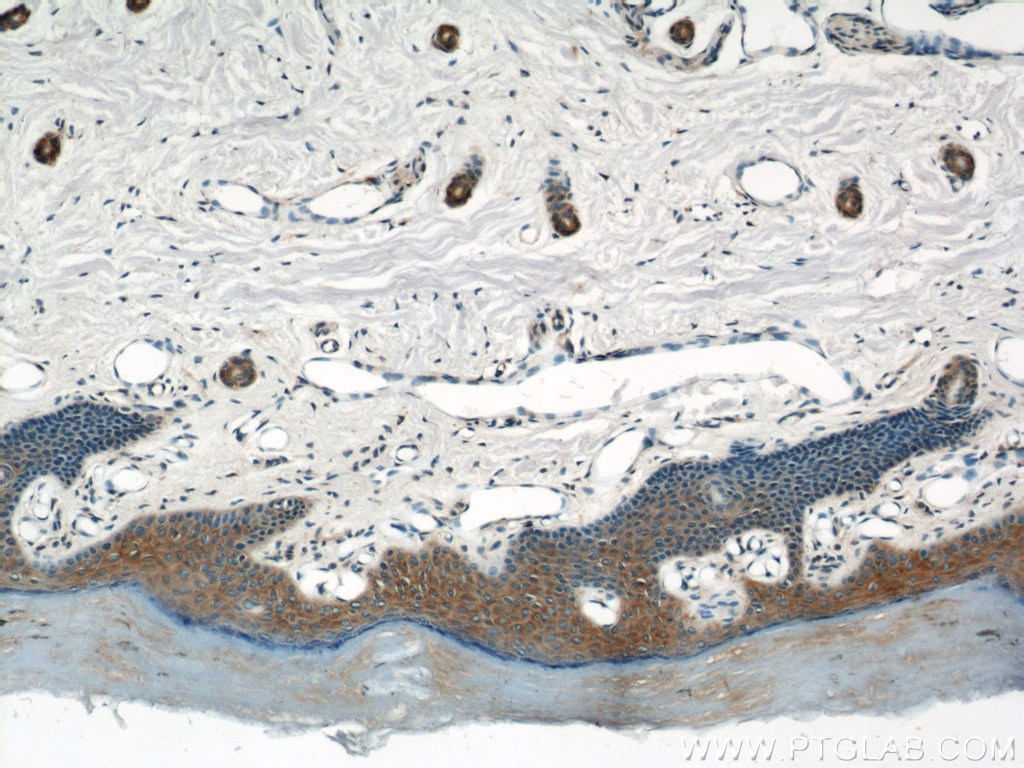 Immunohistochemistry (IHC) staining of human skin tissue using EFEMP2 Polyclonal antibody (12004-1-AP)