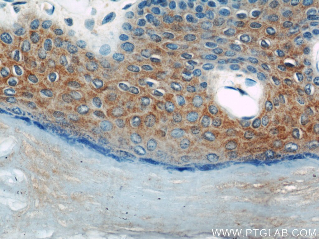 IHC staining of human skin using 12004-1-AP