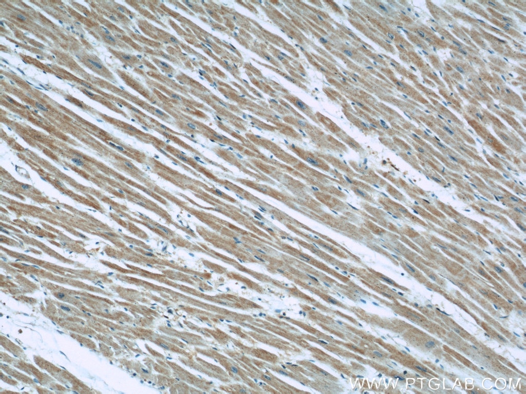 Immunohistochemistry (IHC) staining of human heart tissue using EFEMP2 Polyclonal antibody (12004-1-AP)