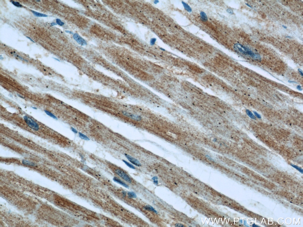 Immunohistochemistry (IHC) staining of human heart tissue using EFEMP2 Polyclonal antibody (12004-1-AP)