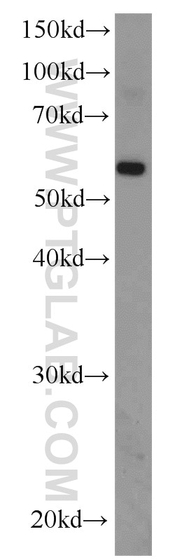 Western Blot (WB) analysis of mouse kidney tissue using EFEMP2 Polyclonal antibody (12004-1-AP)