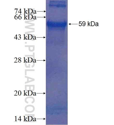 EFEMP2 fusion protein Ag2640 SDS-PAGE