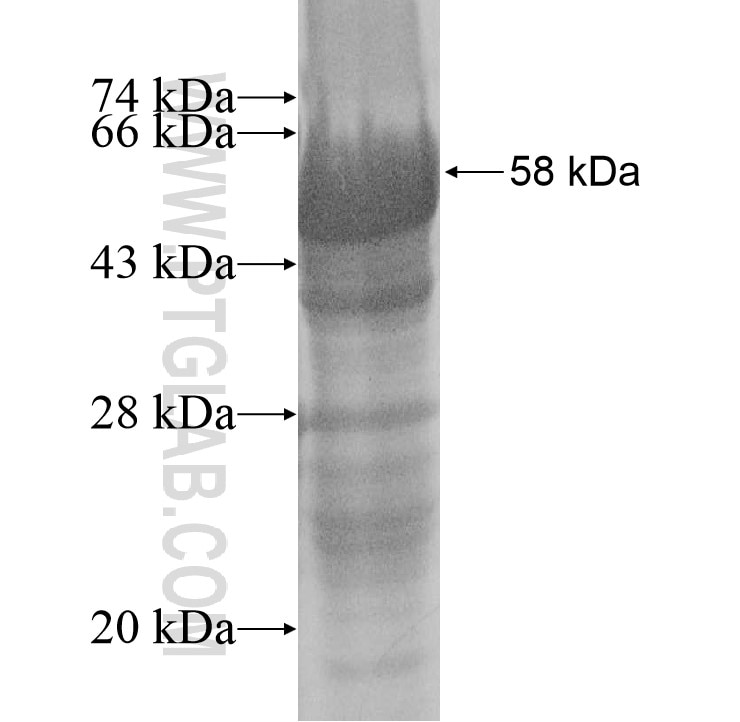 EFHA1 fusion protein Ag14914 SDS-PAGE