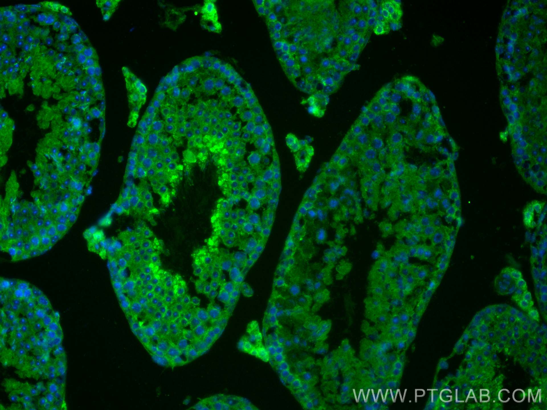 Immunofluorescence (IF) / fluorescent staining of mouse testis tissue using EFHB Polyclonal antibody (17352-1-AP)