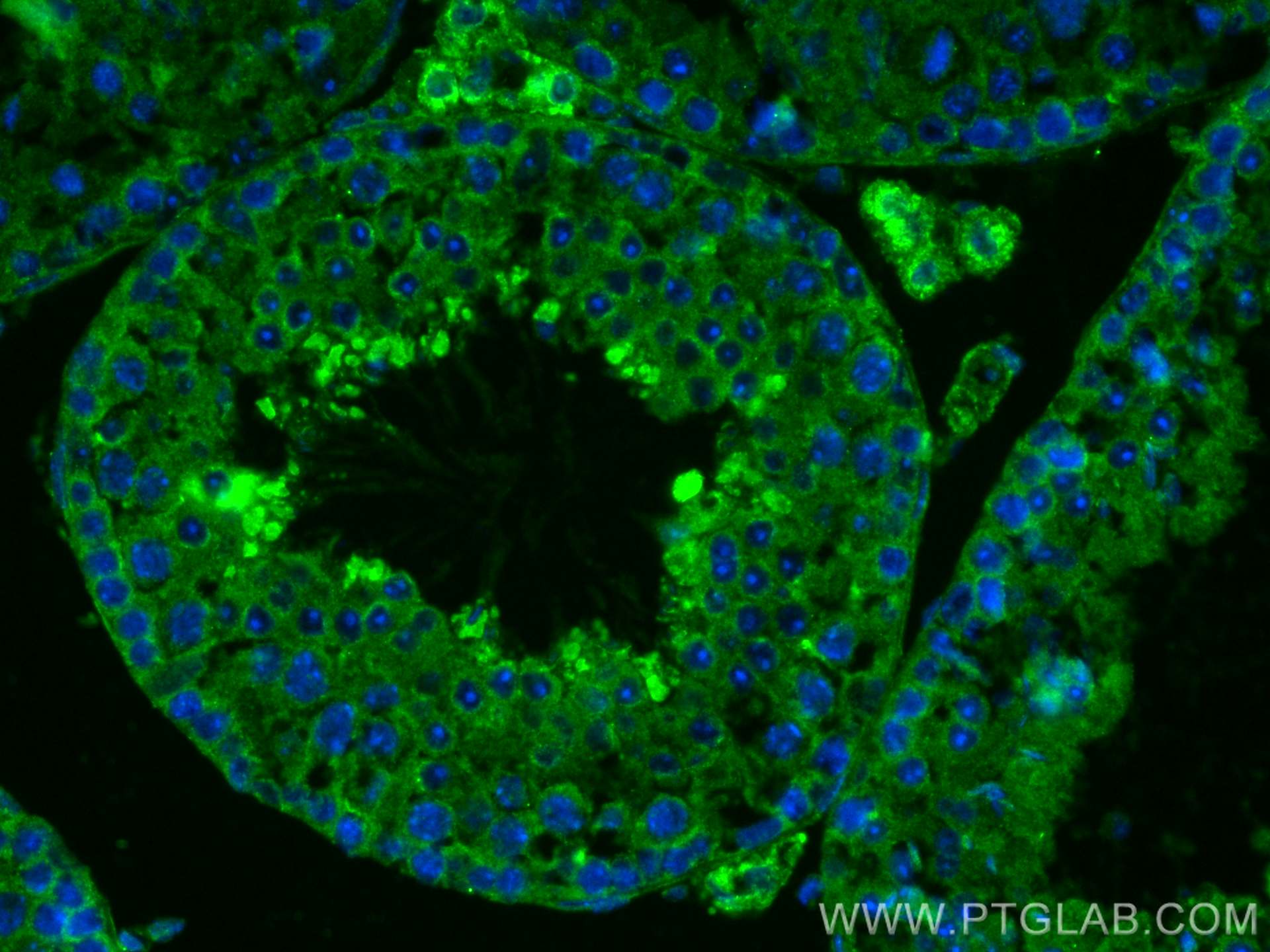 Immunofluorescence (IF) / fluorescent staining of mouse testis tissue using EFHB Polyclonal antibody (17352-1-AP)