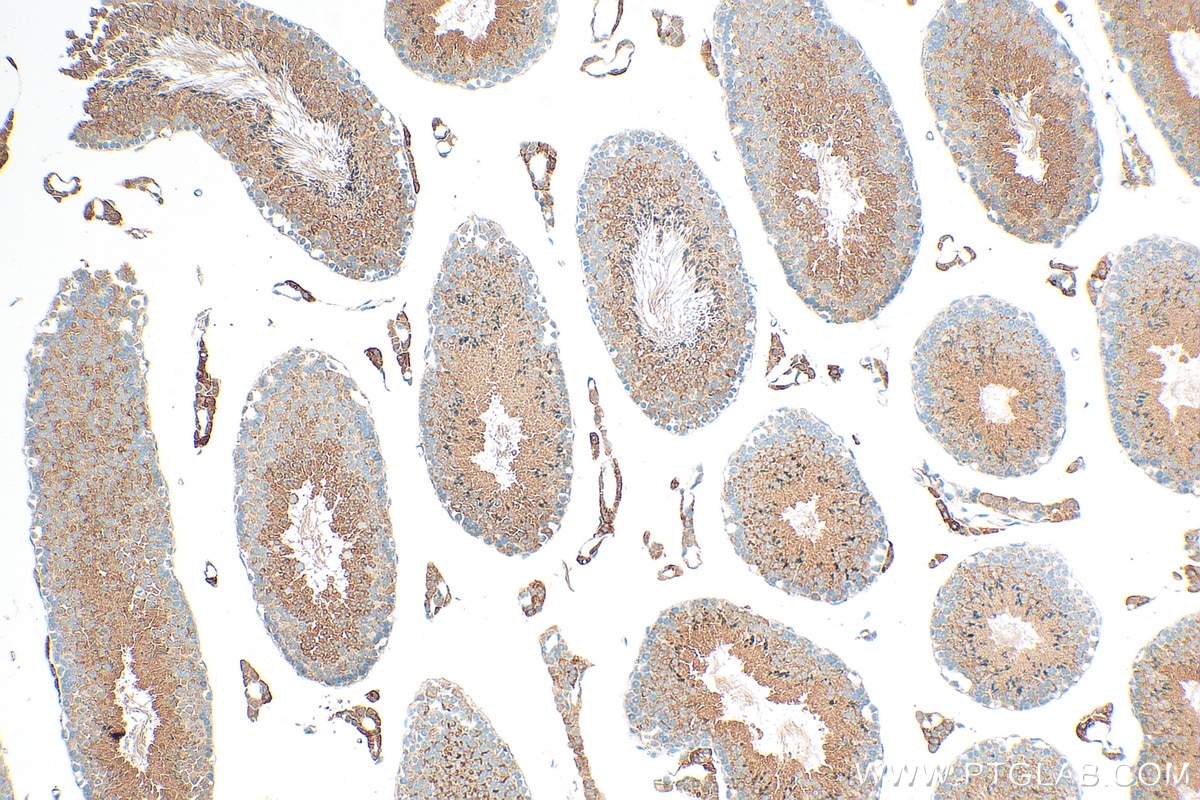 Immunohistochemistry (IHC) staining of mouse testis tissue using EFHB Polyclonal antibody (17352-1-AP)