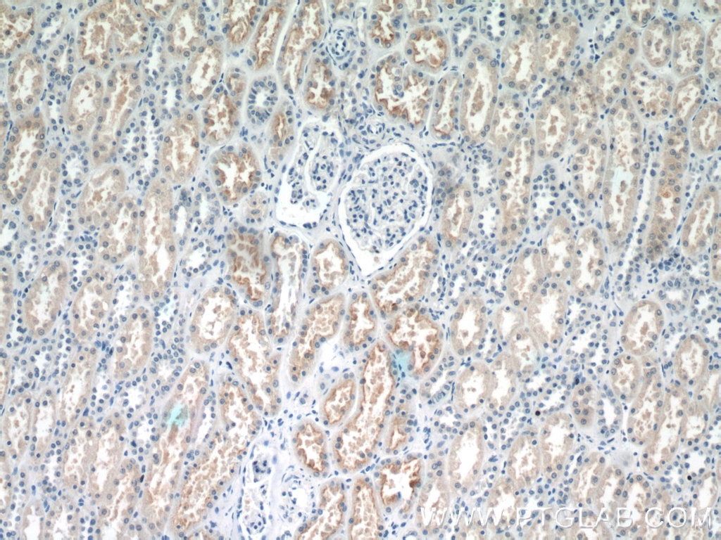 Immunohistochemistry (IHC) staining of human kidney tissue using EFHD1 Polyclonal antibody (19854-1-AP)