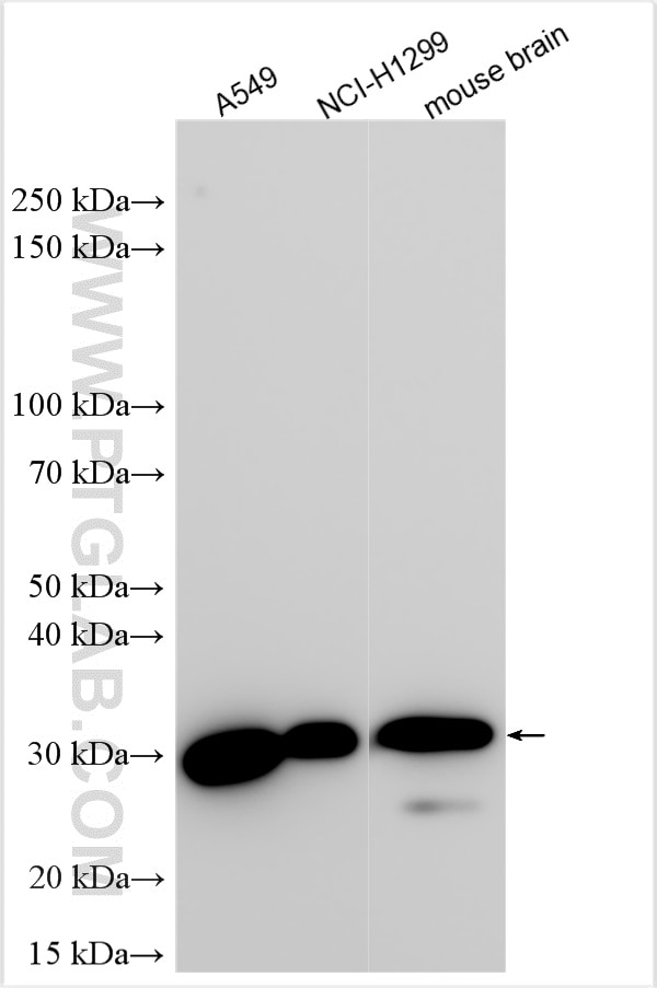 Western Blot (WB) analysis of various lysates using EFHD2 Polyclonal antibody (31624-1-AP)