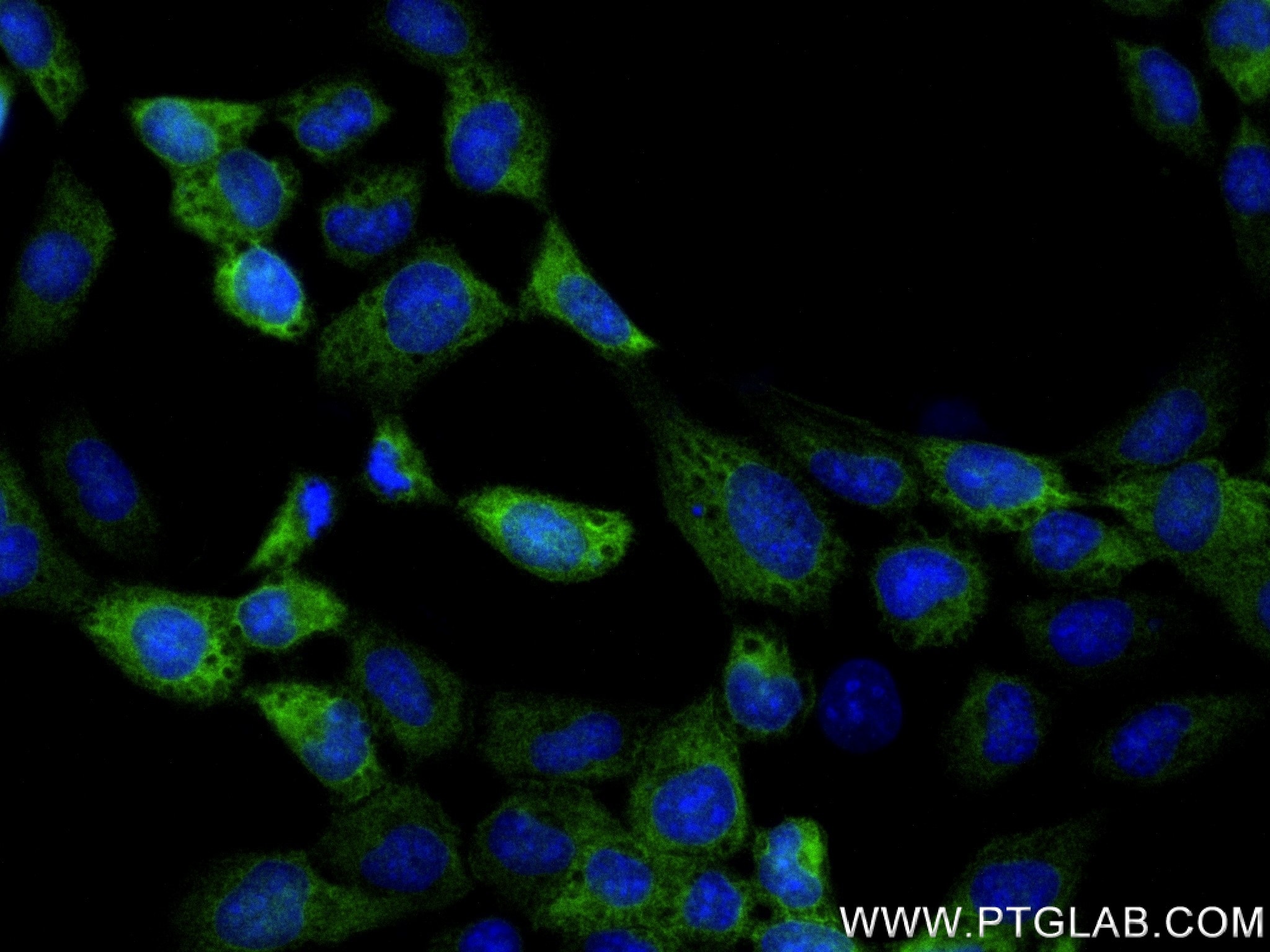 Immunofluorescence (IF) / fluorescent staining of A431 cells using EFHD2 Recombinant antibody (83264-5-RR)