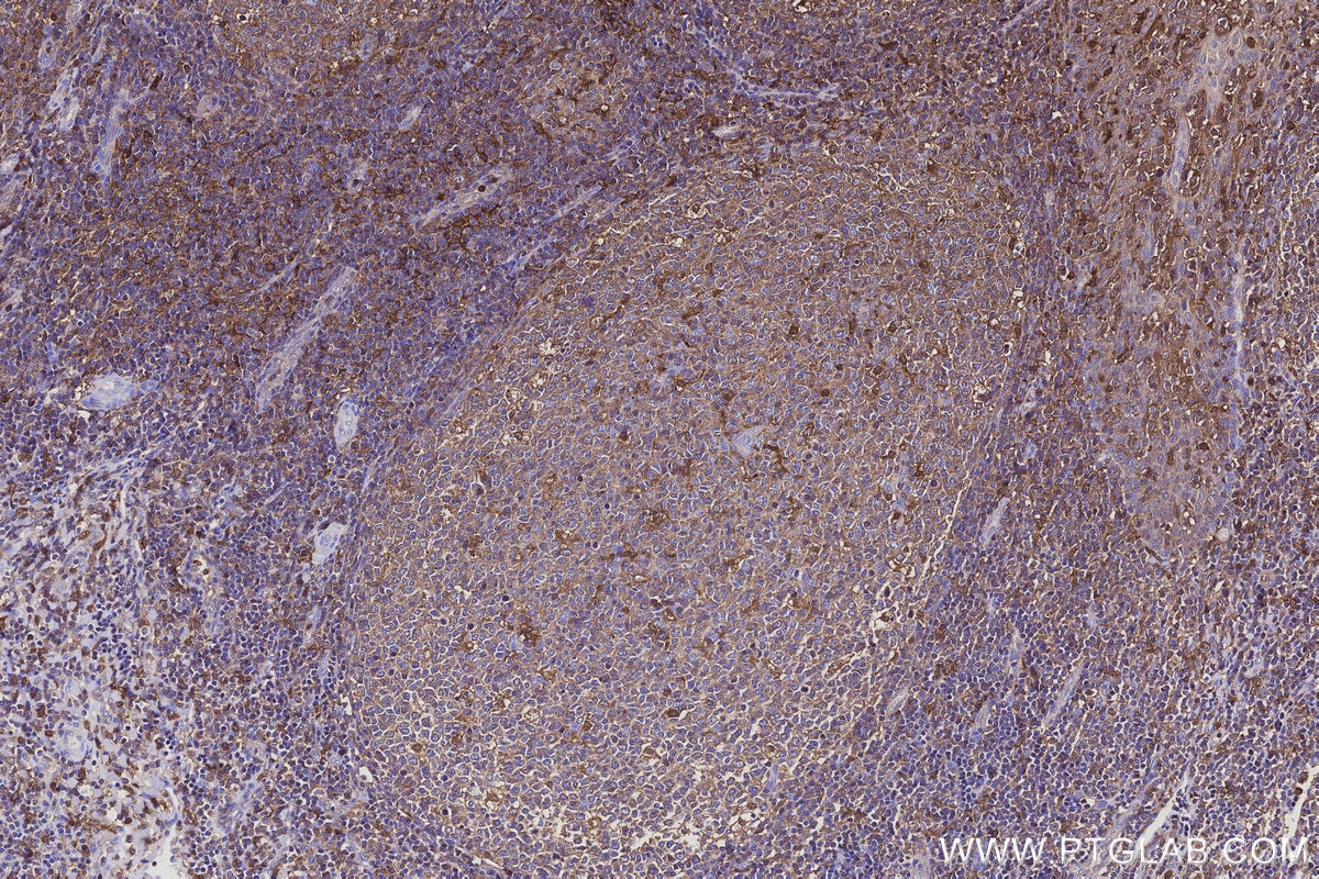 IHC staining of human tonsillitis using 83264-5-RR Immunohistochemistry (IHC) staining of human tonsillitis tissue using EFHD2 Recombinant monoclonal antibody (83264-5-RR)