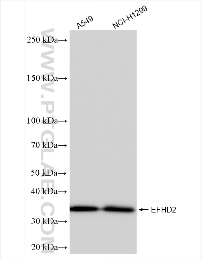Western Blot (WB) analysis of various lysates using EFHD2 Recombinant antibody (83264-5-RR)