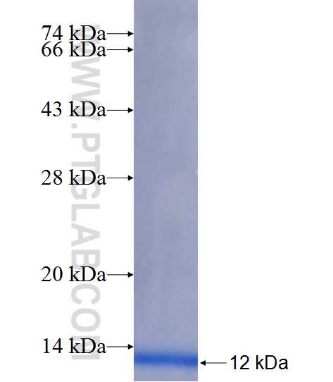 EFNA1 fusion protein Ag25868 SDS-PAGE
