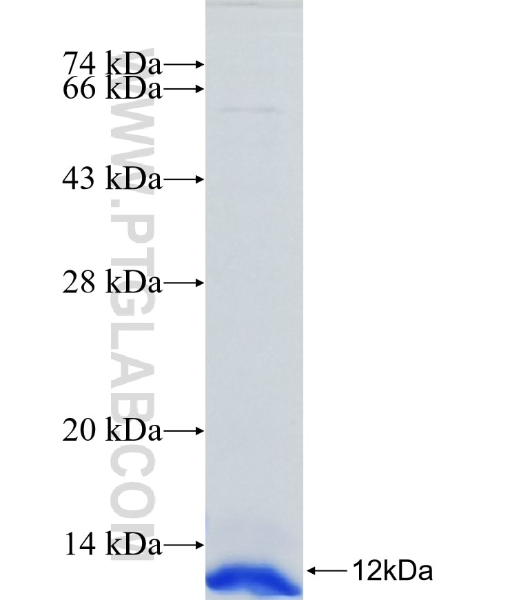 EFNA1 fusion protein Ag25868 SDS-PAGE