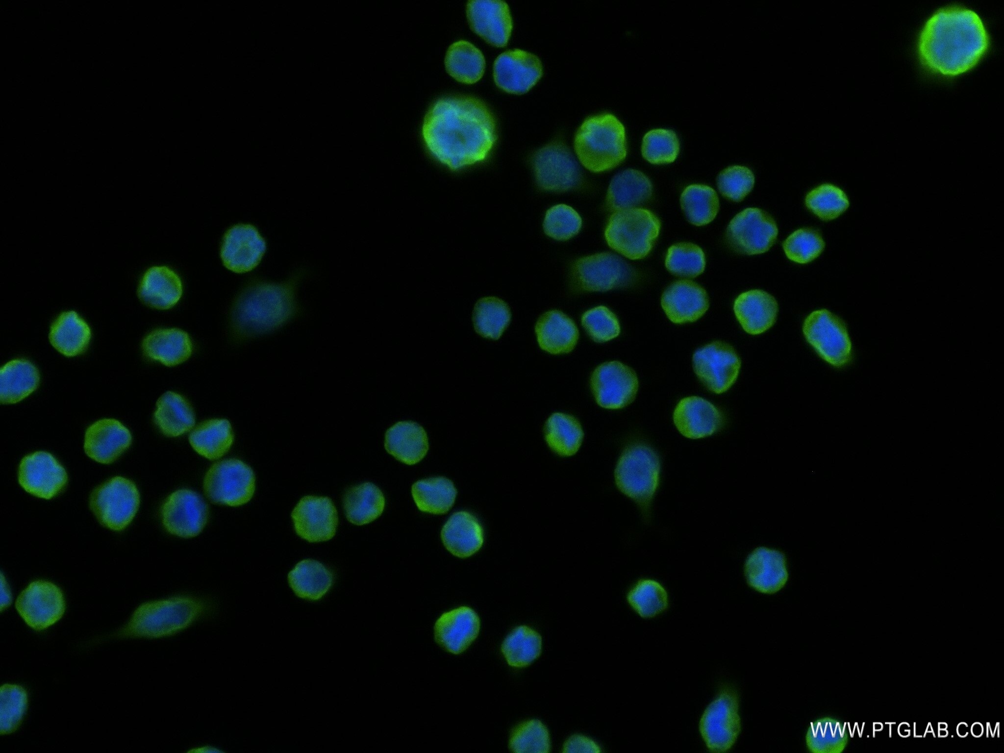 Immunofluorescence (IF) / fluorescent staining of COLO 205 cells using EFNA2 Recombinant antibody (82951-1-RR)