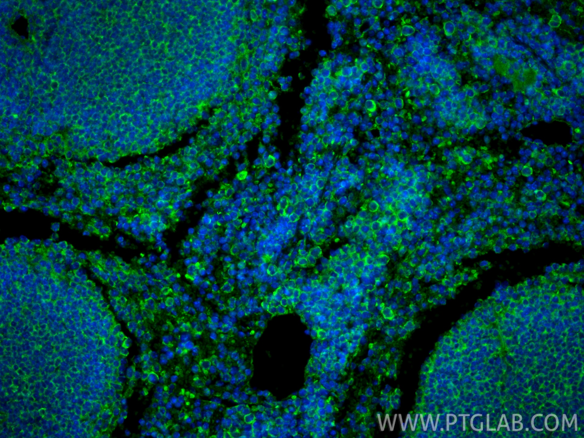 Immunofluorescence (IF) / fluorescent staining of mouse spleen tissue using Ephrin A3 Polyclonal antibody (12480-1-AP)