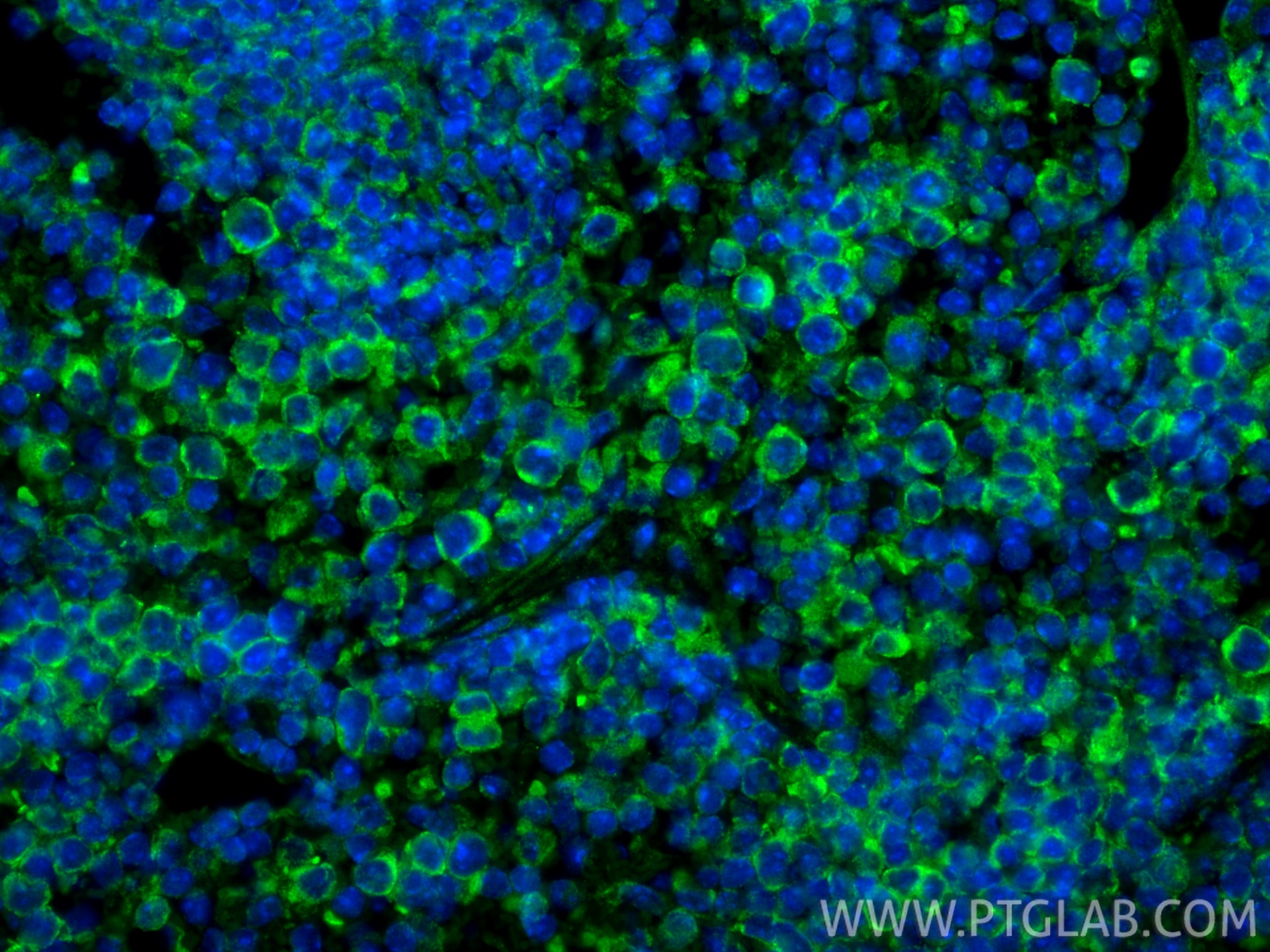Immunofluorescence (IF) / fluorescent staining of mouse spleen tissue using Ephrin A3 Polyclonal antibody (12480-1-AP)