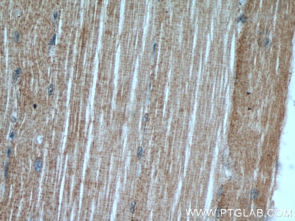 Immunohistochemistry (IHC) staining of human skeletal muscle tissue using Ephrin A3 Polyclonal antibody (12480-1-AP)