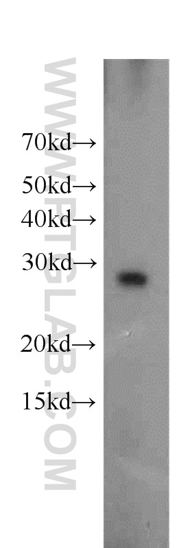 Western Blot (WB) analysis of human brain tissue using Ephrin A3 Polyclonal antibody (12480-1-AP)