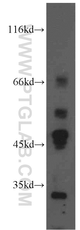 Western Blot (WB) analysis of A549 cells using Ephrin A3 Polyclonal antibody (12480-1-AP)