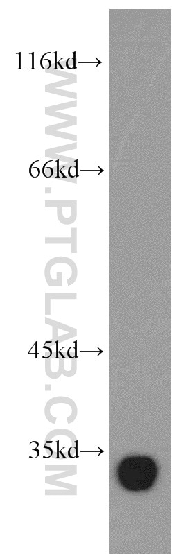 Western Blot (WB) analysis of human brain tissue using Ephrin A3 Polyclonal antibody (12480-1-AP)