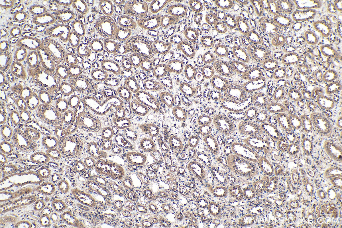 Immunohistochemistry (IHC) staining of human kidney tissue using Ephrin B1 Polyclonal antibody (12999-1-AP)