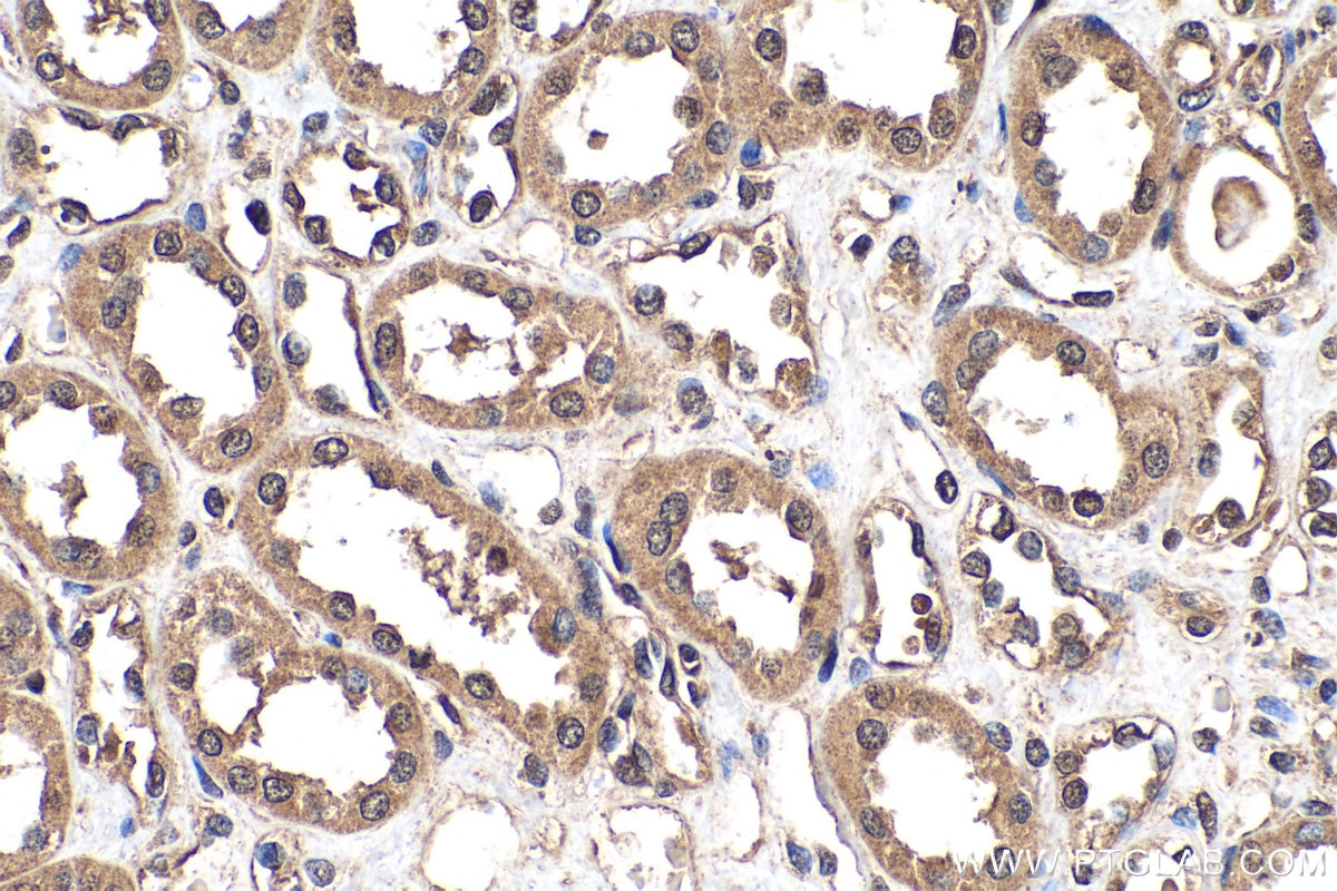 Immunohistochemistry (IHC) staining of human kidney tissue using Ephrin B1 Polyclonal antibody (12999-1-AP)