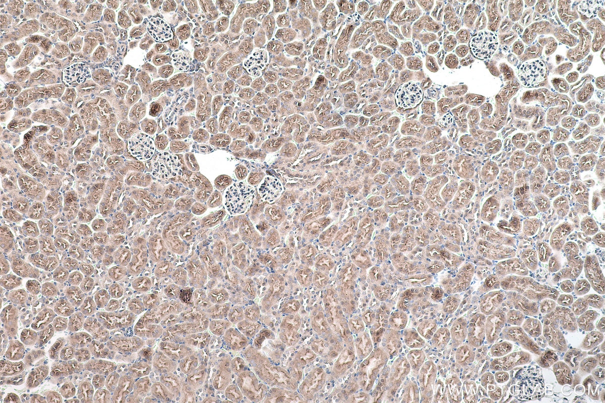 IHC staining of mouse kidney using 12999-1-AP