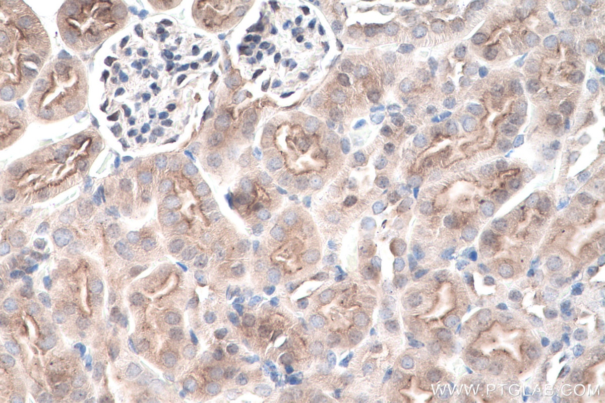 Immunohistochemistry (IHC) staining of mouse kidney tissue using Ephrin B1 Polyclonal antibody (12999-1-AP)