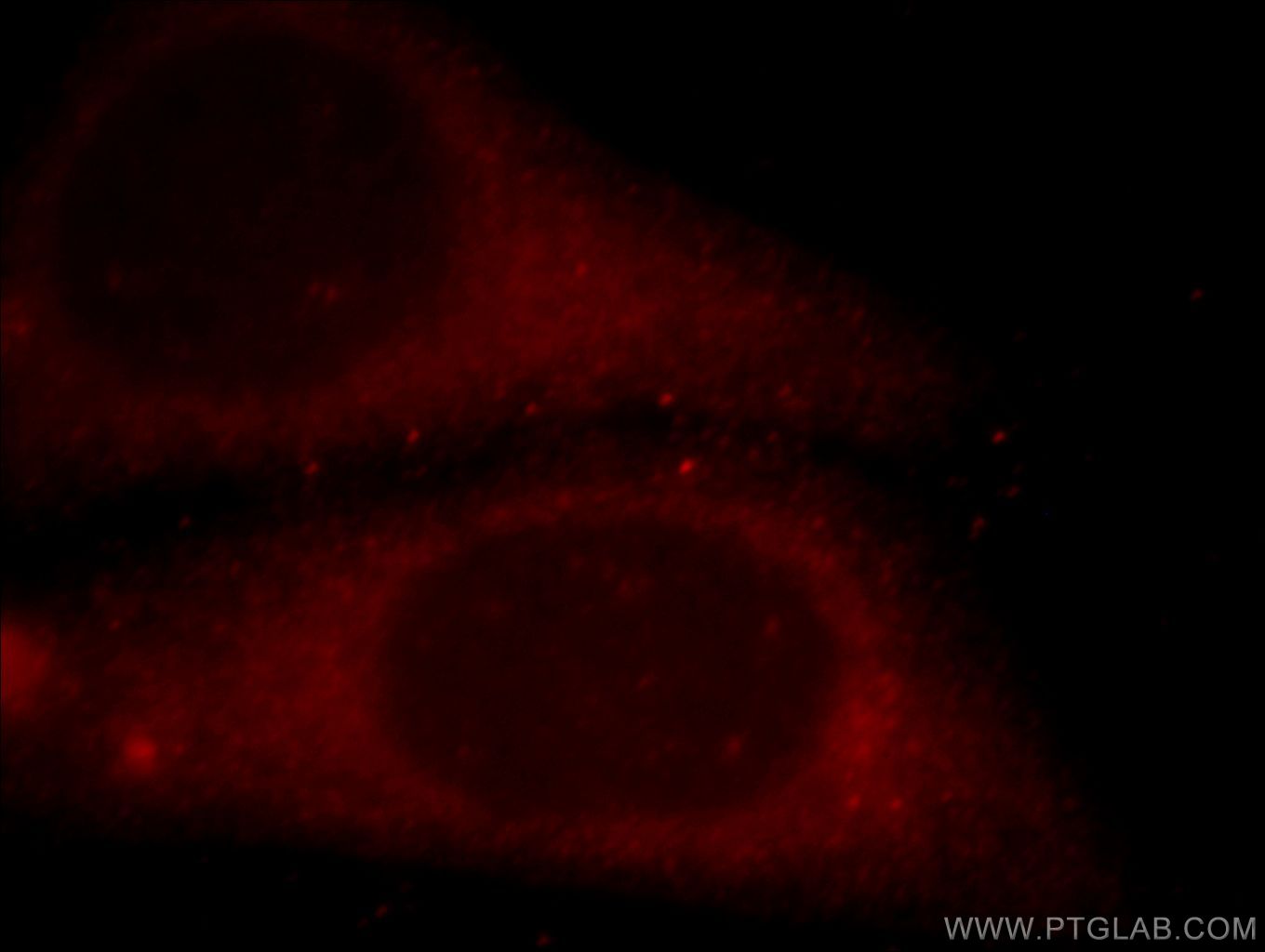 Immunofluorescence (IF) / fluorescent staining of HepG2 cells using EFS Polyclonal antibody (20538-1-AP)