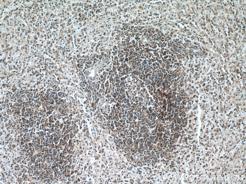 Immunohistochemistry (IHC) staining of human spleen tissue using EFS Polyclonal antibody (20538-1-AP)
