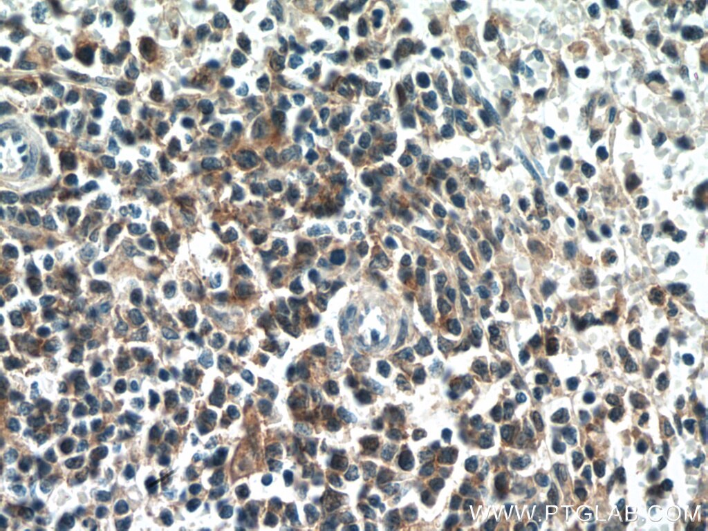 Immunohistochemistry (IHC) staining of human spleen tissue using EFS Polyclonal antibody (20538-1-AP)