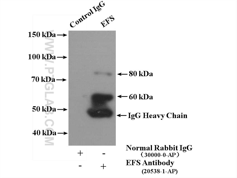 Immunoprecipitation (IP) experiment of mouse thymus tissue using EFS Polyclonal antibody (20538-1-AP)