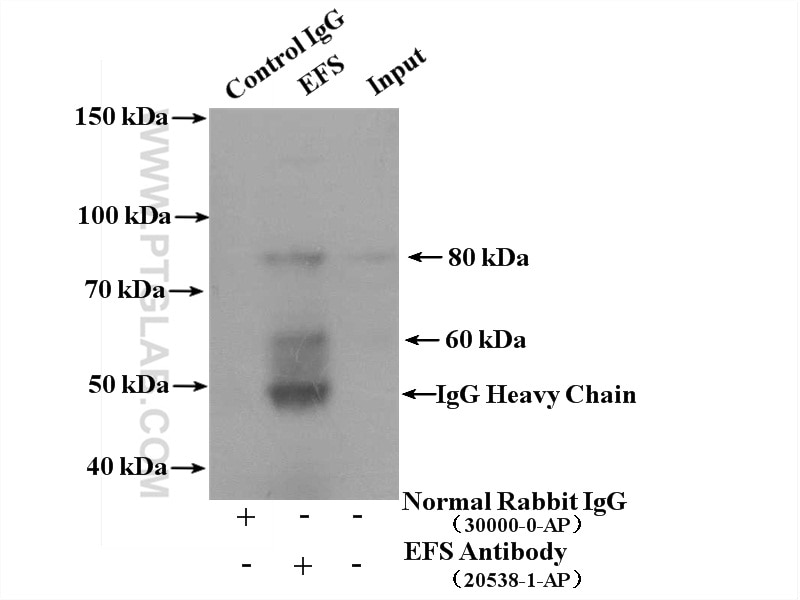 Immunoprecipitation (IP) experiment of mouse thymus tissue using EFS Polyclonal antibody (20538-1-AP)