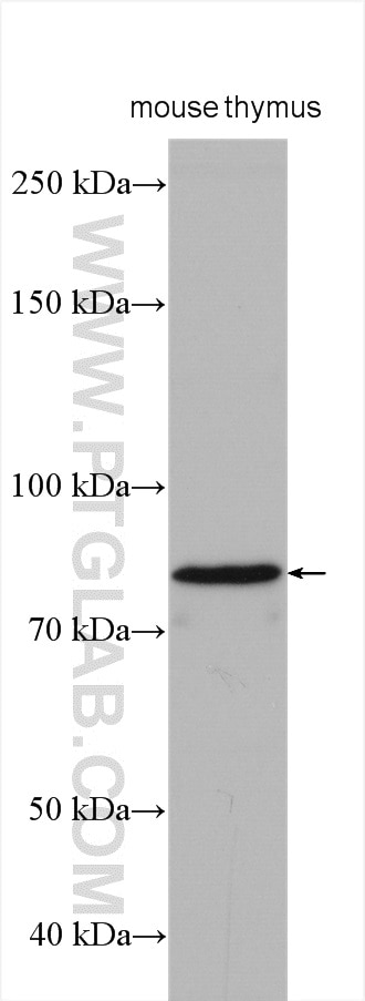 Western Blot (WB) analysis of various lysates using EFS Polyclonal antibody (20538-1-AP)