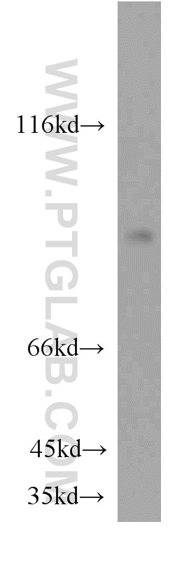 WB analysis of human placenta using 20538-1-AP