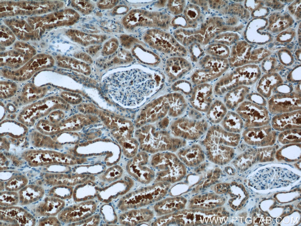 Immunohistochemistry (IHC) staining of human kidney tissue using EFTUD1 Polyclonal antibody (24729-1-AP)