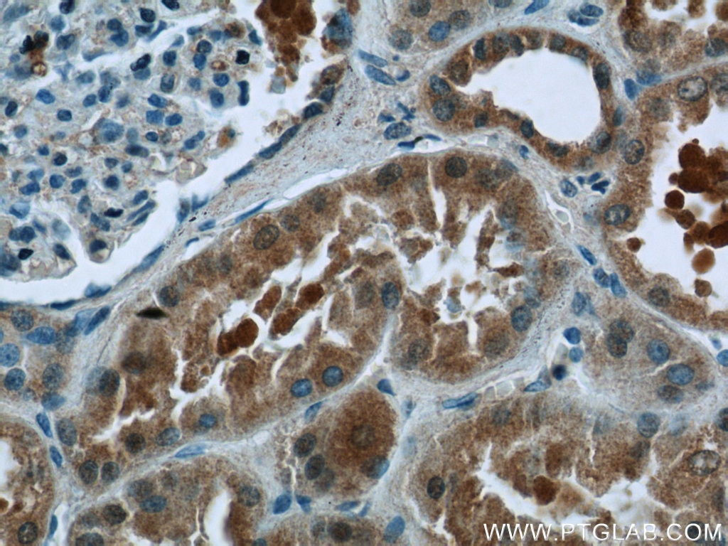 Immunohistochemistry (IHC) staining of human kidney tissue using EFTUD1 Polyclonal antibody (24729-1-AP)