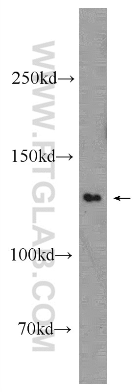 Western Blot (WB) analysis of mouse brain tissue using EFTUD1 Polyclonal antibody (24729-1-AP)